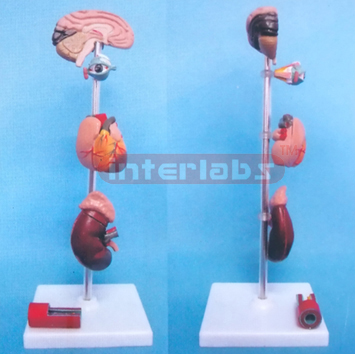 MIDDLE VERTICAL HYPERTENSION MODEL BRAIN, EYE, HEART, KIDNEY, BLOOD TUBE (WEST TYPE)